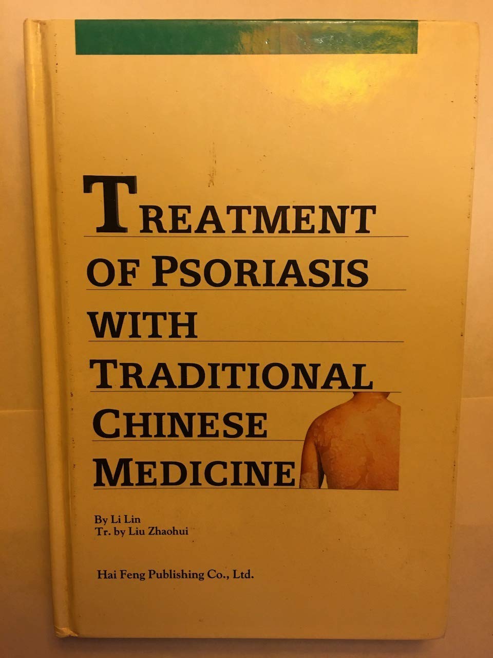 Treatment of psoriasis with traditional Chinese medicine